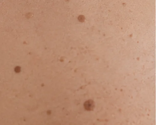 Dermatochirurgie Rostock Dr. Dr. Ole Jung