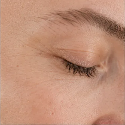Hautverjüngung in Rostock – ästhetische Dermatologie bei Dr. Dr. Ole Jung